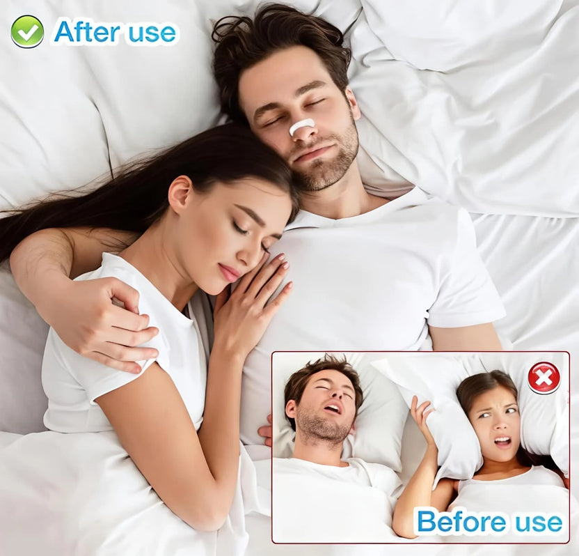 Advanced Breathing Nasal Strip Starter Kit – Anti-Snoring Solution & Nasal Congestion Relief for Deep Sleep & Sports (Pack of 1)